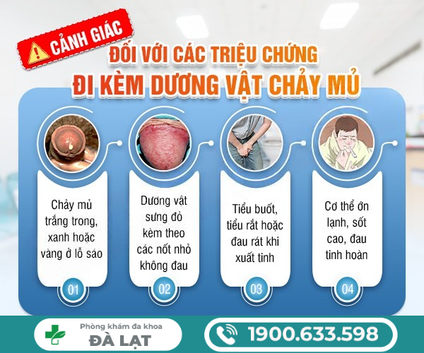 Hình ảnh minh họa